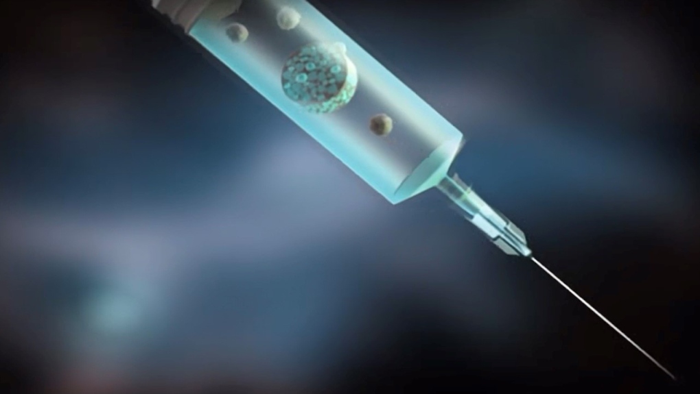 An injectable potentially heart healing patch is seen inside a syringe in this supplied computer image from Western University. 