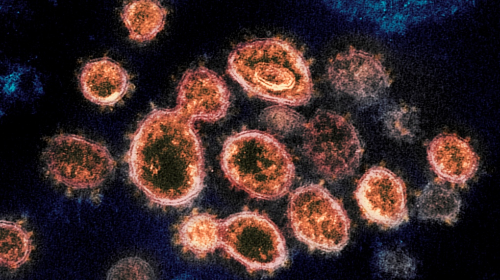FILE - This 2020 electron microscope image provided by the National Institute of Allergy and Infectious Diseases - Rocky Mountain Laboratories shows SARS-CoV-2 virus particles which cause COVID-19. (NIAID-RML via AP)