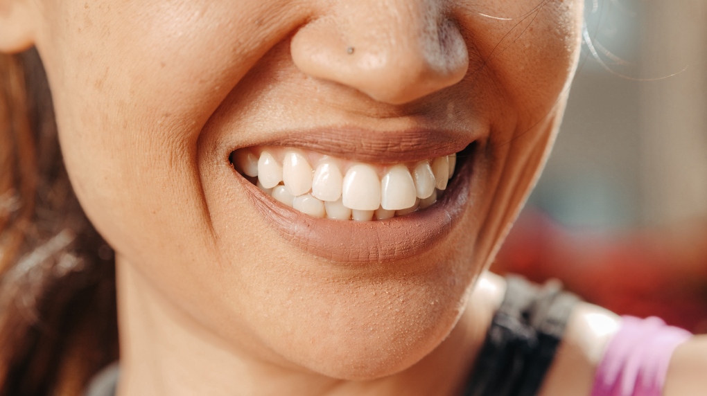 Teeth-whitening products with carbide peroxide may be doing more damage to your teeth than you thought. (pexels.com / Kindel Media)